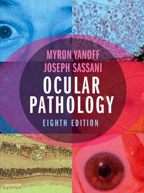 Ocular Pathology 