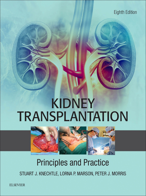 Kidney Transplantation - Principles and Practice 