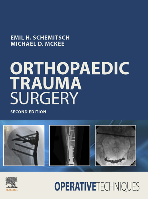 Cover image for book Operative Techniques: Orthopaedic Trauma Surgery