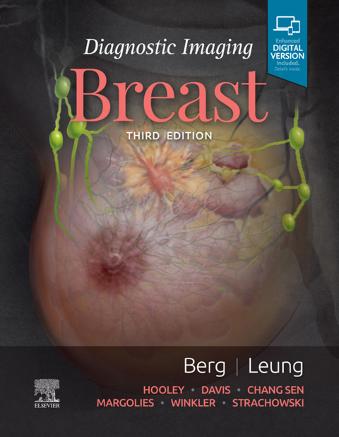 Cover image for book Diagnostic Imaging: Breast