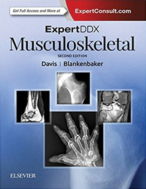 ExpertDDx: Musculoskeletal 