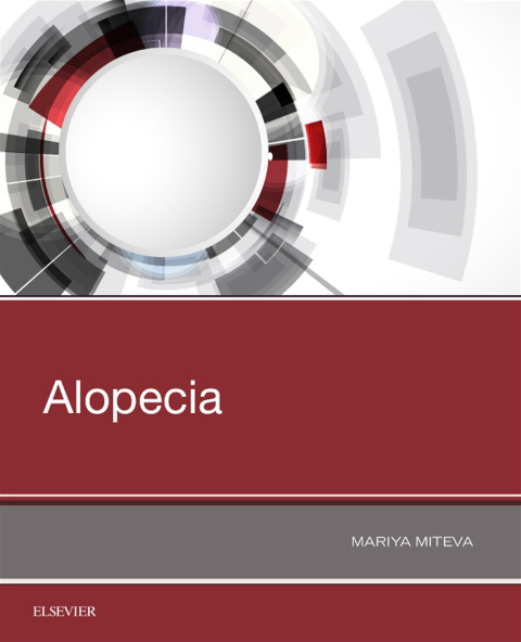 Cover image for book Alopecia