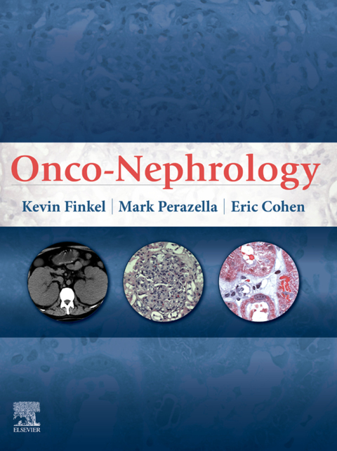 Onco-Nephrology E-Book 