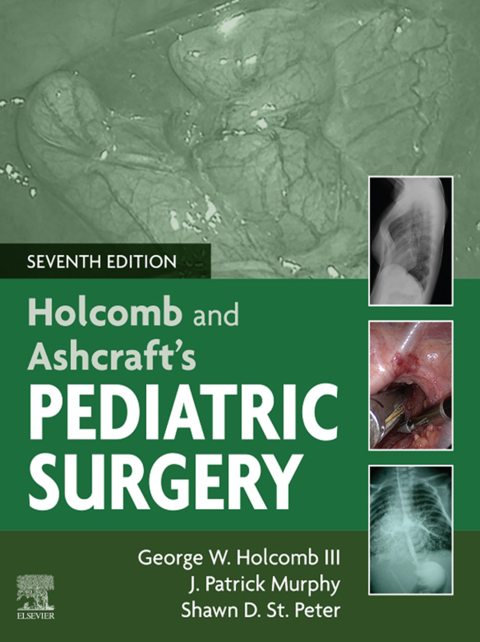 Holcomb and Ashcraft's Pediatric Surgery 