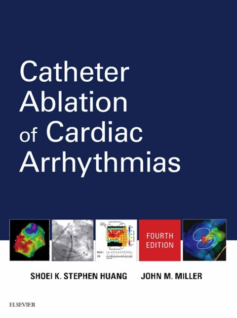 Cover image for book Catheter Ablation of Cardiac Arrhythmias