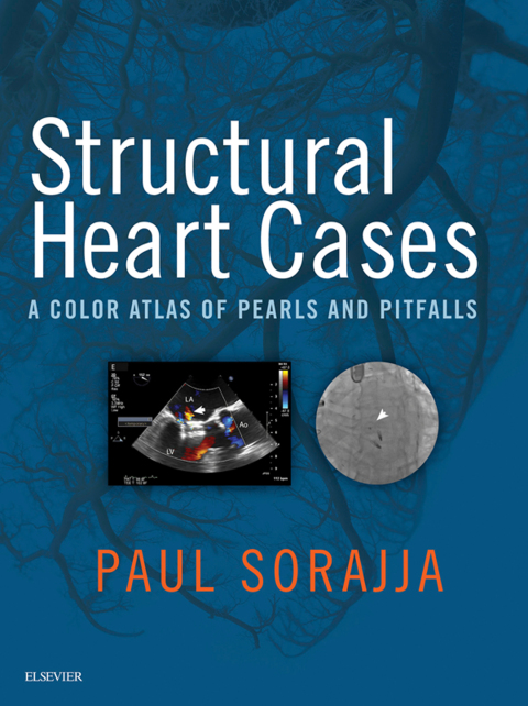 Structural Heart Cases 
