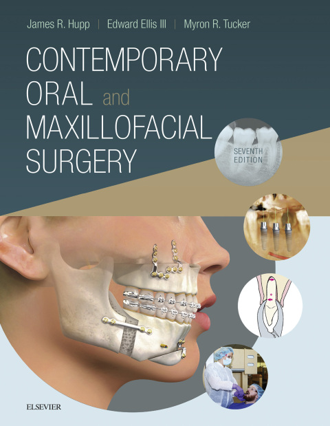 Contemporary Oral and Maxillofacial Surgery Elsevier eBook on VitalSource