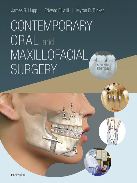 Cover image for book Contemporary Oral and Maxillofacial Surgery