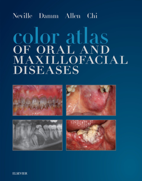 Cover image for book Color Atlas of Oral and Maxillofacial Diseases Elsevier eBook on VitalSource