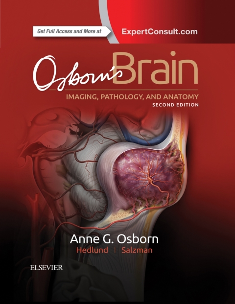 Osborn's Brain E-Book 