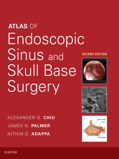 Cover image for book Atlas of Endoscopic Sinus and Skull Base Surgery