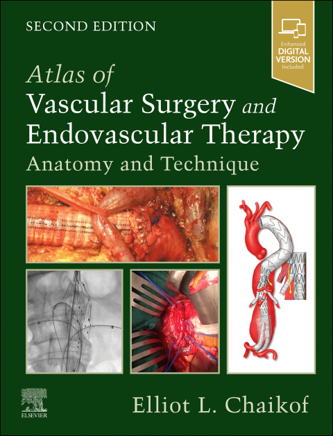 Cover image for book Atlas of Vascular Surgery and Endovascular Therapy