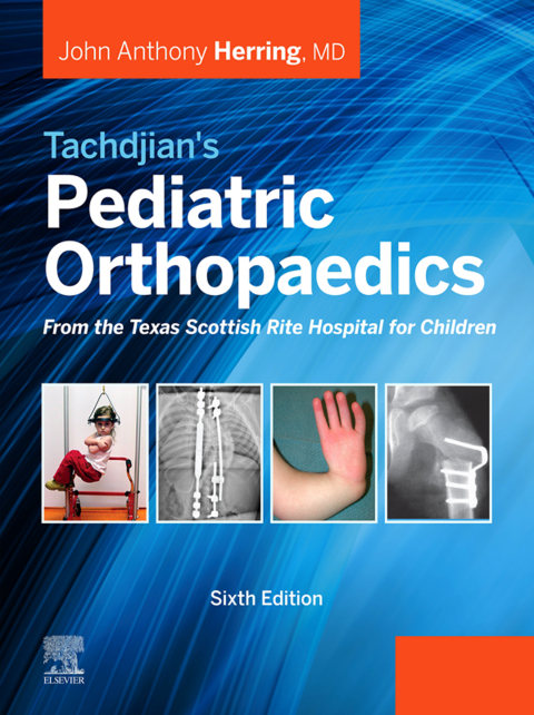 Cover image for book Tachdjian's Pediatric Orthopaedics: From the Texas Scottish Rite Hospital for Children E-Book
