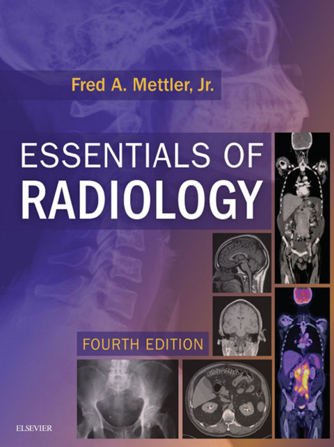 Cover image for book Essentials of Radiology