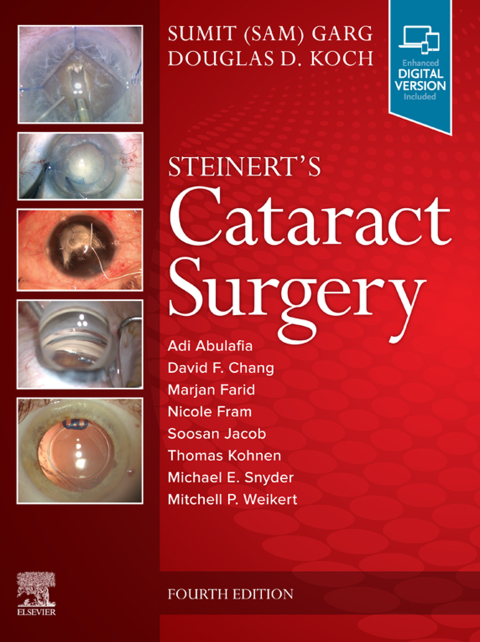 Cover image for book Cataract Surgery