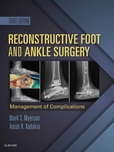 Cover image for book Reconstructive Foot and Ankle Surgery: Management of Complications