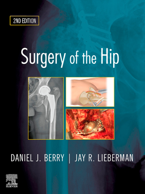 Cover image for book Surgery of the Hip E-Book