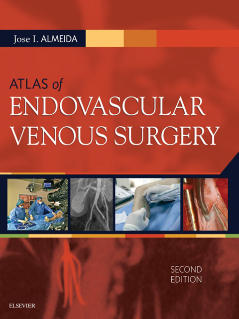 Cover image for book Atlas of Endovascular Venous Surgery