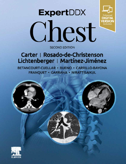 ExpertDDx: Chest 
