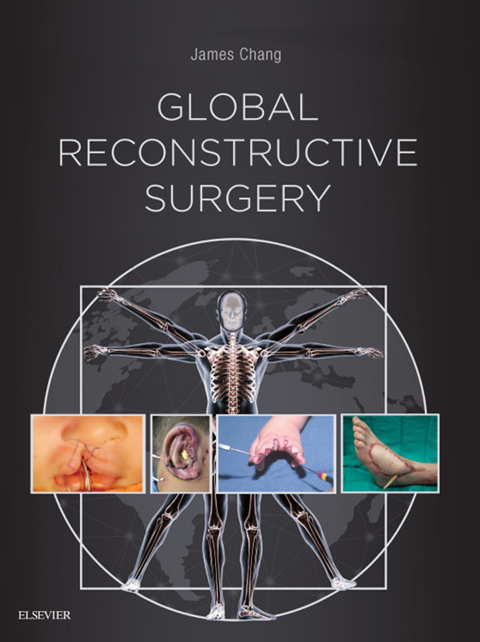 Cover image for book Global Reconstructive Surgery
