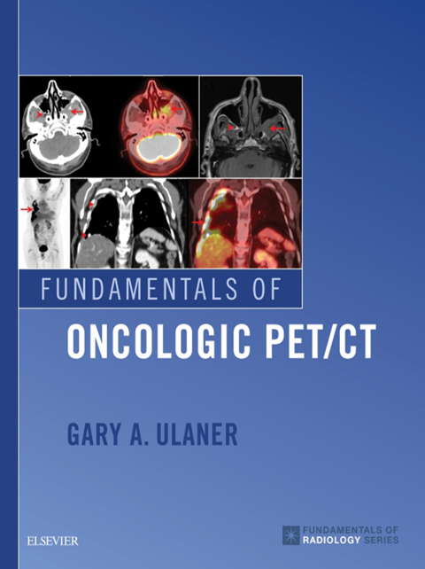 Cover image for book Fundamentals of Oncologic PET/CT