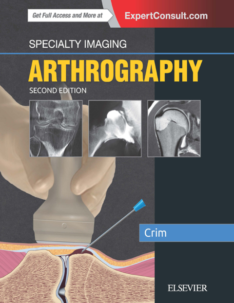 Specialty Imaging: Arthrography E-Book 