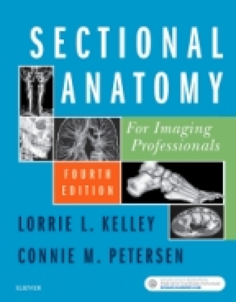 Cover image for book Mosby's Radiography Online for Sectional Anatomy for Imaging Professionals