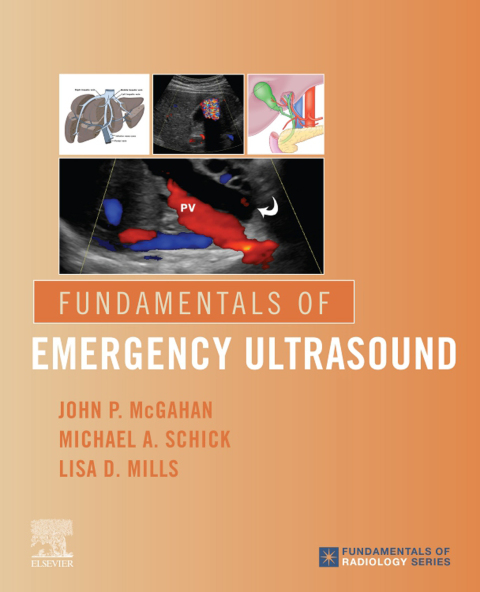 Cover image for book Fundamentals of Emergency Ultrasound