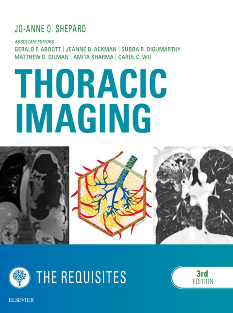 Cover image for book Thoracic Imaging The Requisites