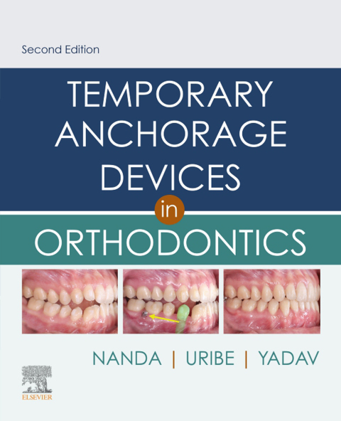 Cover image for book Temporary Anchorage Devices in Orthodontics