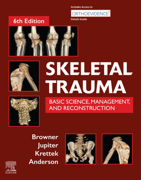 Cover image for book Skeletal Trauma