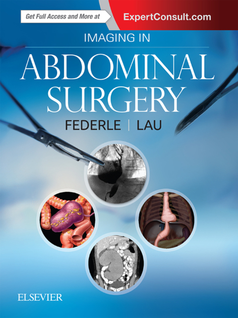 Imaging in Abdominal Surgery 