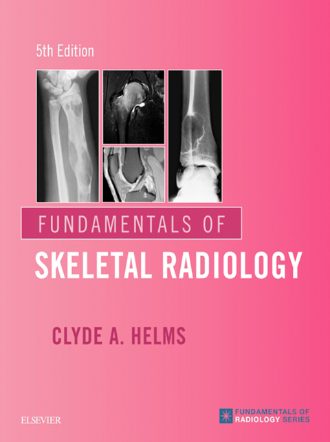 Cover image for book Fundamentals of Skeletal Radiology E-Book