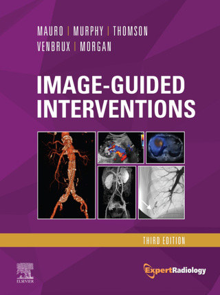Image-Guided Interventions