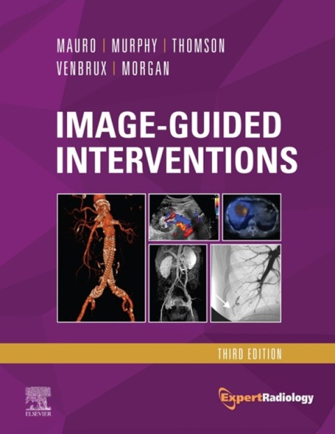 Image-Guided Interventions 