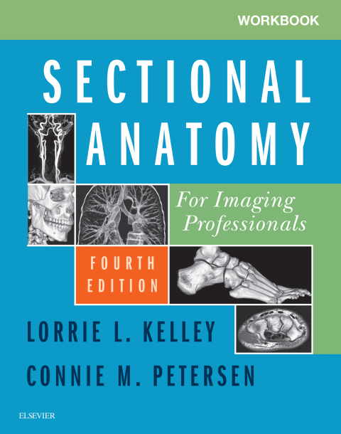 Cover image for book Workbook for Sectional Anatomy for Imaging Professionals