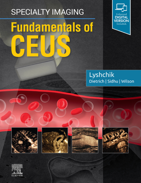 Cover image for book Specialty Imaging: Fundamentals of CEUS E-Book