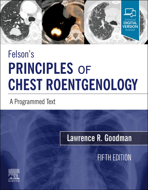Cover image for book Felson's Principles of Chest Roentgenology