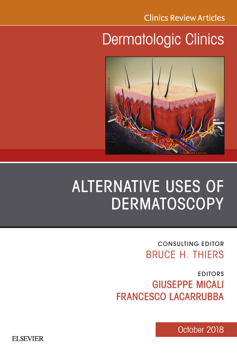 Cover image for book Alternative Uses of Dermatoscopy, An Issue of Dermatologic Clinics