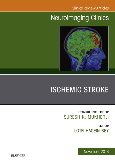 Cover image for book Ischemic Stroke, An Issue of Neuroimaging Clinics of North America