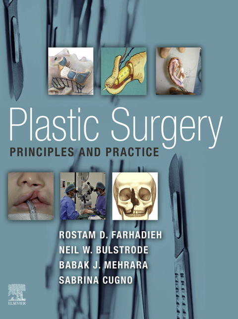 Cover image for book Plastic Surgery - Principles and Practice