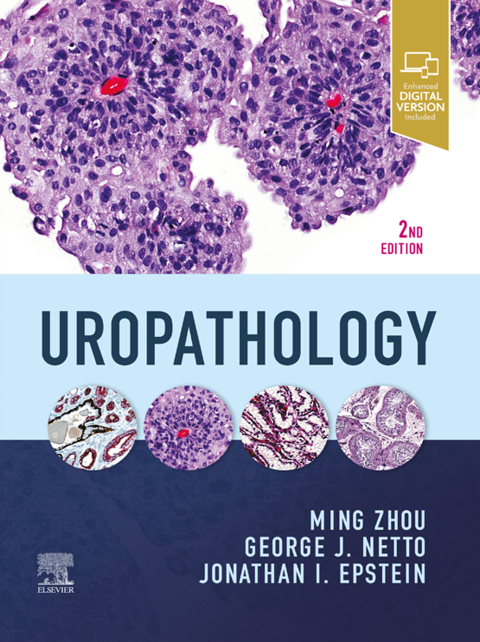 Cover image for book Uropathology E-Book