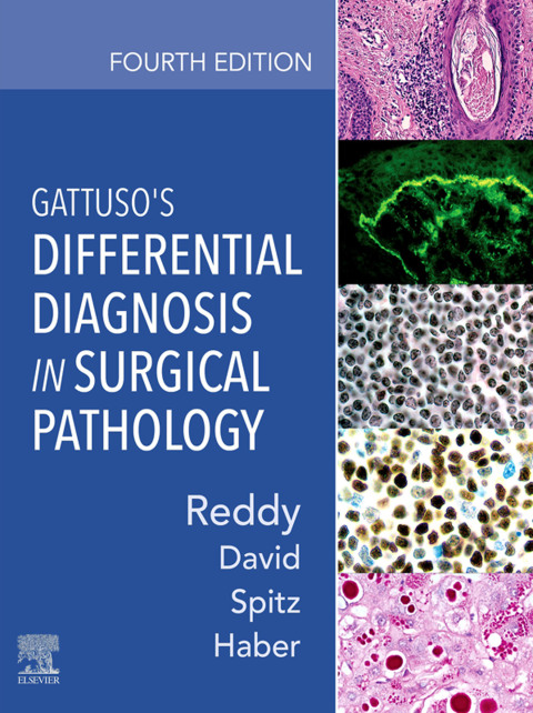 Cover image for book Gattuso's Differential Diagnosis in Surgical Pathology