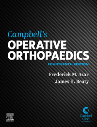 Campbell's Operative Orthopaedics 14th Edition