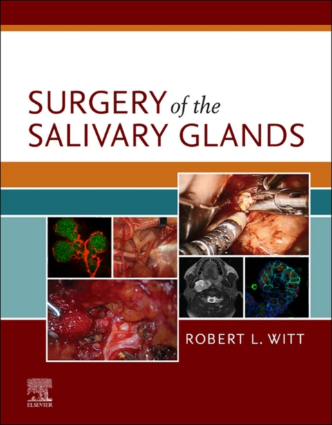 Cover image for book Surgery of the Salivary Glands