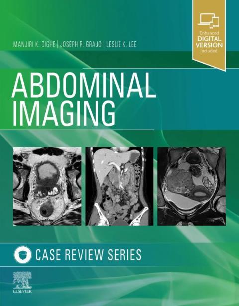 Cover image for book Abdominal Imaging