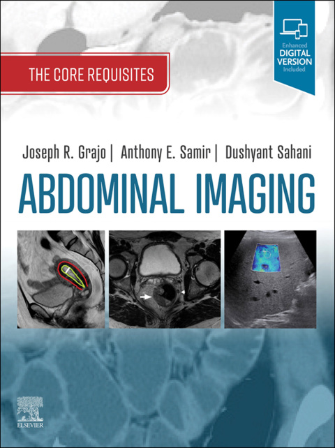 Cover image for book Abdominal Imaging