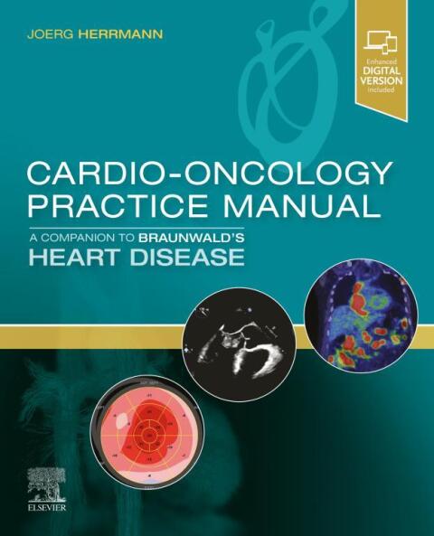 Cover image for book Cardio-Oncology Practice Manual: A Companion to Braunwald’s Heart Disease
