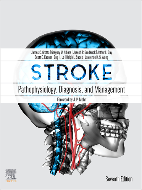Cover image for book Stroke