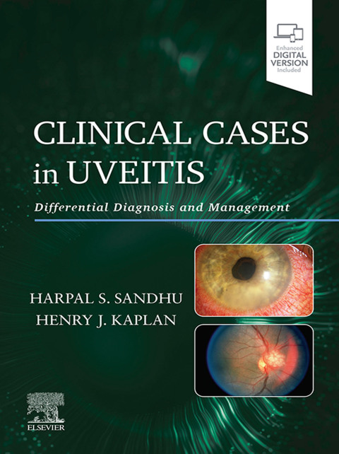 Cover image for book Clinical Cases in Uveitis